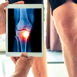 knee.jpg